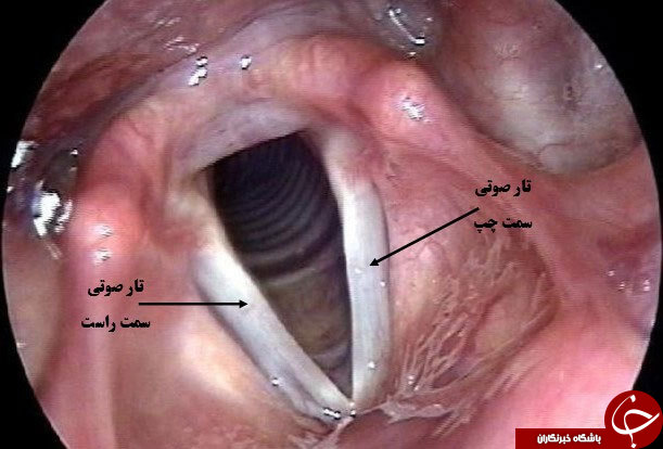 عجیب ترین عمل های جراحی پلاستیک/ از درشت کردن چشم تا جوان کردن صدا