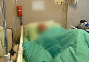 سوختگی ناشی از بی احتیاطی