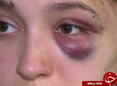 حمله وحشیانه اراذل به دختر نوجوان در روز روشن/مادر سنگدل کودک بی&zwnj;گناه را به زنجیر کشید+تصاویر