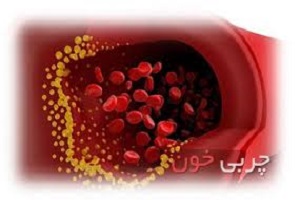 نكاتی كه بايد در مورد داروهای ضد چربی خون بدانيد