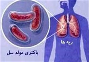 مرکز درمان سل در شهرستان زابل به بهره‌برداری می‌رسد