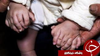 پسربچه چینی با 31 انگشت!+ تصاویر