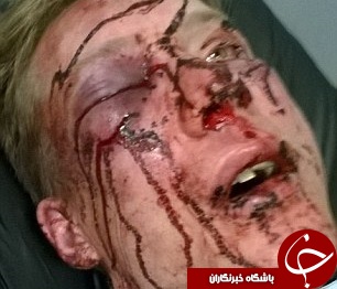 ضرب و شتم وحشیانه داماد سابق به خاطر یک سوء تفاهم+تصاویر