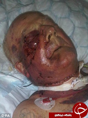 قتل پیرمرد 80 ساله بخاطر اسکناس/ پلیس:صورت پیرمرد صحنه جرم است!+تصاویر