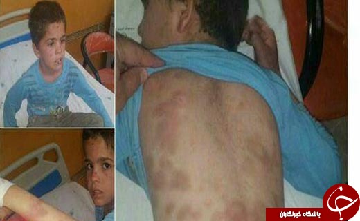 جزئیاتی از وضعیت دانش&zwnj;آموز تنبیه شده لرستانی + عکس