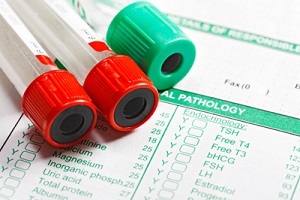 «Ferritin»/ راهنمای تفسیر آزمایش خون در خانه