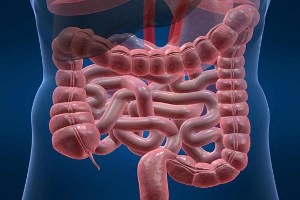 کولیت السراتیو؛ بیماری مزمن التهابی روده