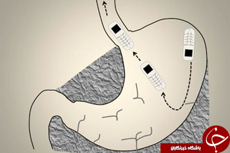 نجات زندانی پس از بلعیدن گوشی تلفن همراه+ تصاویر