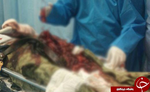 راکب موتور سوار دست و پایش را از دست داد +&zwnj;عکس ( 18+ )