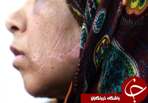تصاویر شکنجه 21 روزه زن بی پناه/او و دخترانش 21 روز غذا نخوردند اما هنوز زنده&zwnj;اند