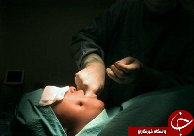 مد این روزها، جراحی چال گونه!