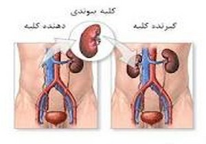 راه اندازی بخش پیوند کبد دردانشگاه علوم پزشکي