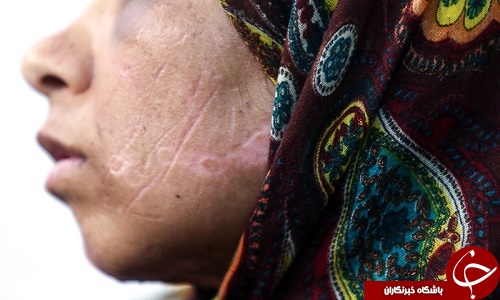 شکنجه یک زن و 2 دخترش/ آنها 21 روز غذا نخوردند اما هنوز زنده&zwnj;اند (+تصاویر)