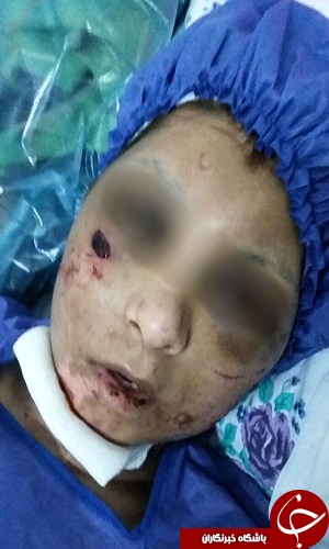 شکنجه یک زن و 2 دخترش/ آنها 21 روز غذا نخوردند اما هنوز زنده&zwnj;اند (+تصاویر)