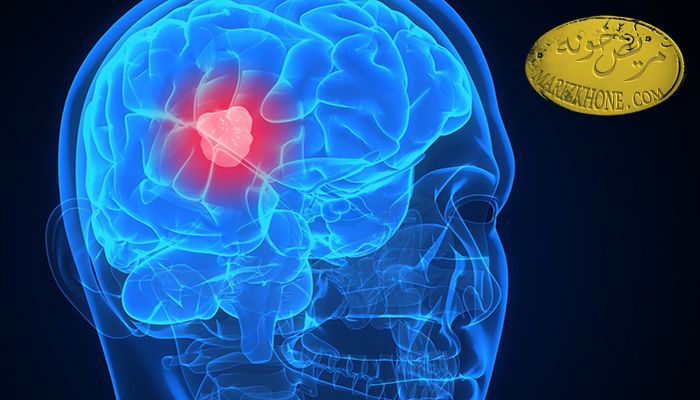 افزایش شانس بهبودی بیماران سرطانی با تکنیک های نوین جراحی