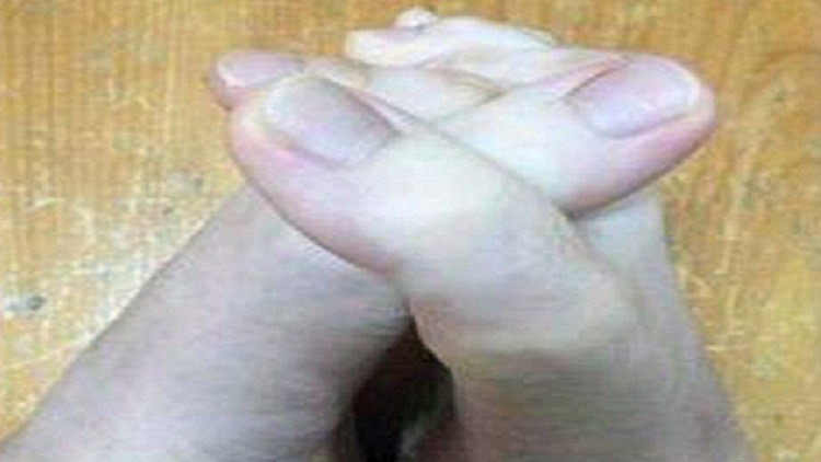 تصاویر حیرت انگیز از پاهای یک دختر تایوانی