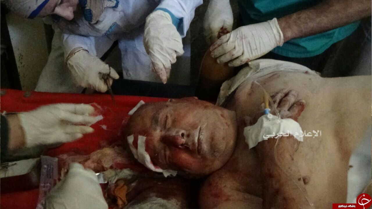 حمله موشکی تروریست های تکفیری به شهرک فوعه + تصاویر