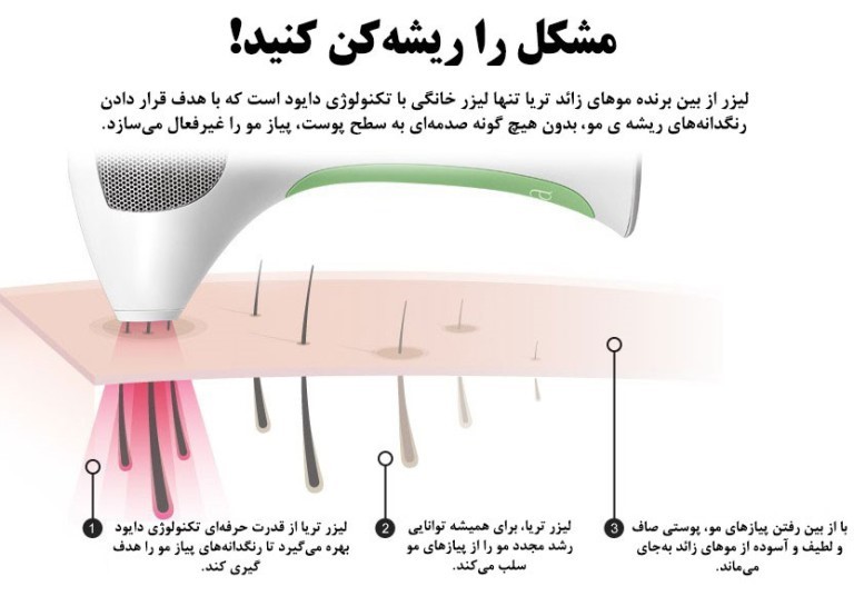 لیزرخانگی تریا بیوتی، تحولی نوین در صنعت زیبایی