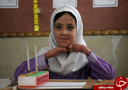 قلب کوچک با روحی بزرگ + تصاویر