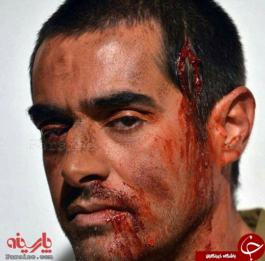عکس/ صورت خونین شهاب حسینی