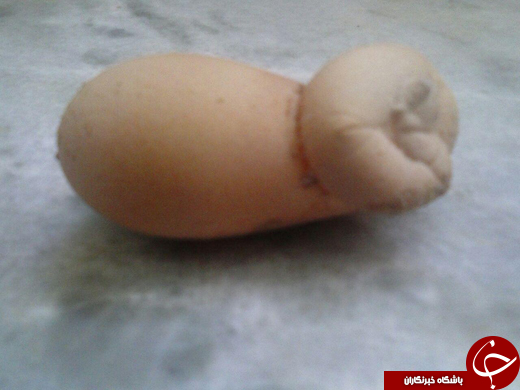 بسته خبری + تصاویر