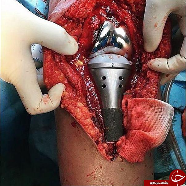 نمایی نزدیک از جراحی  