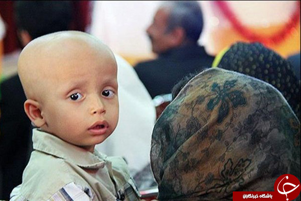 تأمین پلاکت سالم خون دغدغه بزرگ مراکز درمانی و بیماران سرطانی