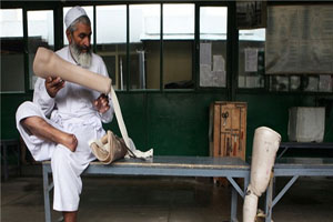یک دکتر افغان با اختراع دستگاهی از قطع دست و پا جلو گیری می کند