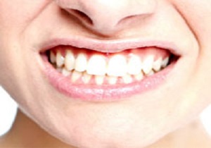 بهترین روش برای سفید کردن دندان
