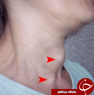 نمک، چنگالی که گلوی شما را می فشارد/ هشدار های جدی مسئولان نسبت به مصرف نمک دریا