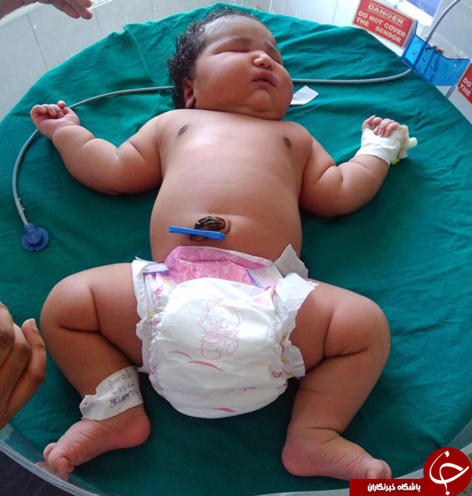 به دنیا آمدن بچه سنگین وزن + تصاویر