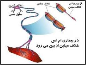 بیش از 527 بیمار ام اس در گلستان