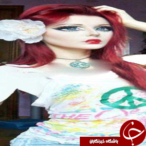 دختری با عمل زیبایی شبیه شخصیت کارتونی شد +عکس