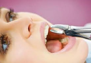 نرخ خدمات دندانپزشكی سليقه ای است؟