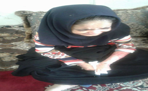 بیماری پروانه ای پوستی ،زیبایی این دختر را دزدید+ تصاویر