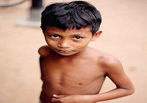سوء تغذیه عامل عمده مرگ و میر خردسالان در دنیا
