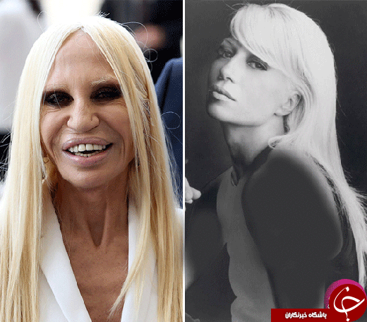 زنانی که با جراحی پلاستیک زشت شدند