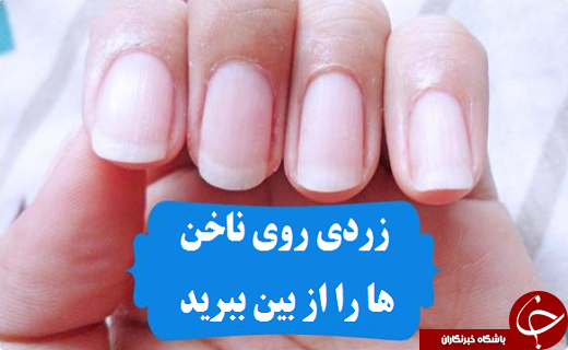 ۷ ترفند برای زیبا شدن
