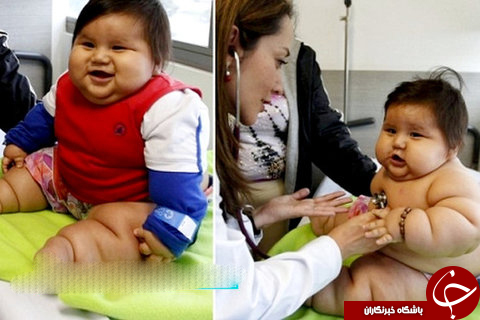 گرسنگی مداوم یک کودک ۲۲ کیلویی در ۱۸ماهگی! +عکس