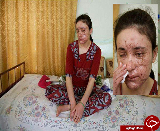 راز های ناگفته دختر فراری از همخوابی های وحشیانه داعش+عکس