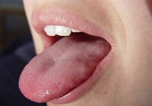 تغییر رنگ زبان را جدی بگیرید!