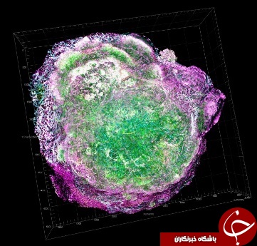 تصاویری زیبا و مسحورکننده از سرطان های مرگبار+ (7 عکس)