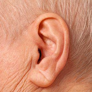ظاهر گوش چه حقایقی را در مورد سلامت انسان بازگو می&zwnj;کند؟