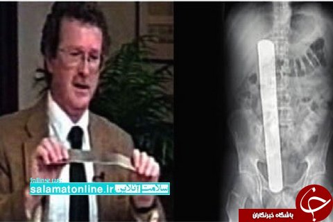 اتفاق هایی که مرز نمی شناسد؛ ۶ خطای مهم پزشکی در جهان