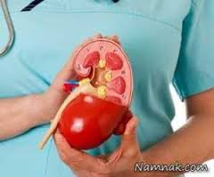 آمادگی 50 نفر برای پیوند کلیه