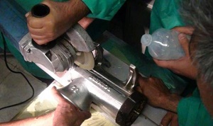 دست پسر بچه 2 ساله در چرخ گوشت گیر کرد