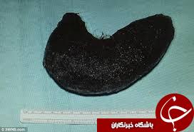 بیماری عجیب 