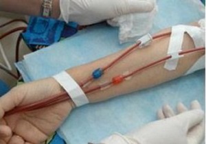 آخرین جزئیات مرگ مشکوک بیماران دیالیزی/ بيماران از نقص ايمنی شديد رنج می بردند