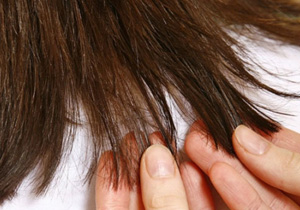 چگونه از موخوره جلوگیری کنیم؟
