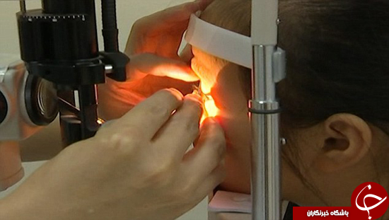 بیرون کشیدن شپش از مژه دختر 5 ساله +تصاویر